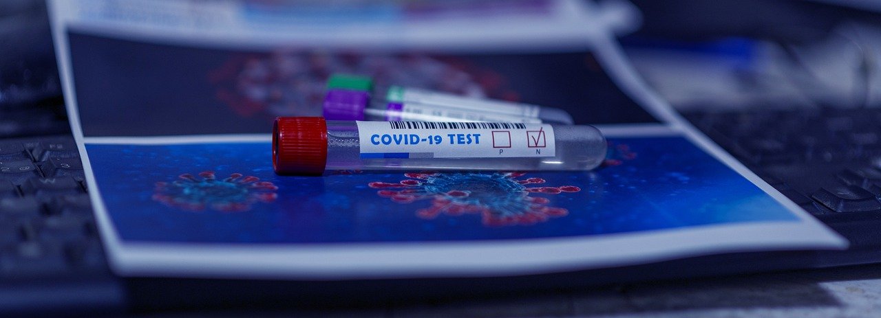 Kein Coronatest: Kein Einlass und zwei Anzeigen